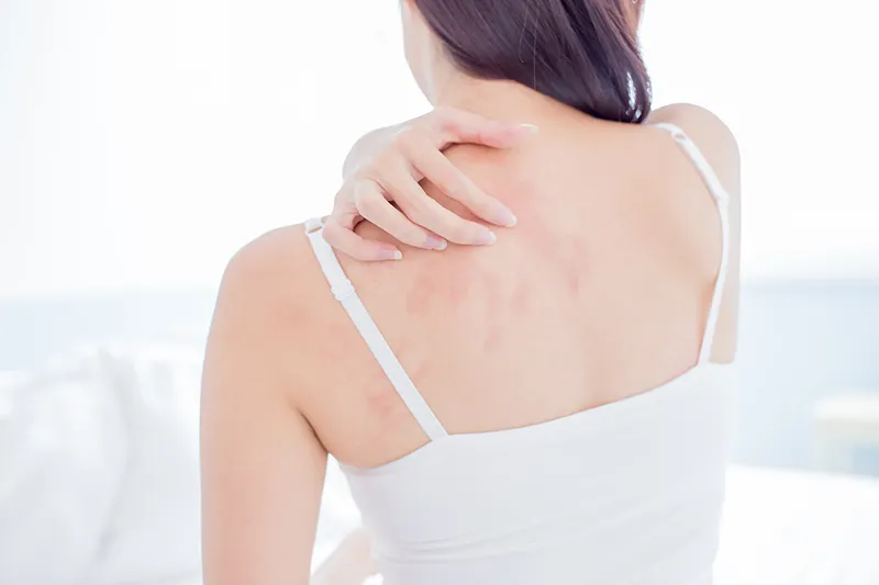 Cahaba Clinical Research - woman itching shoulder