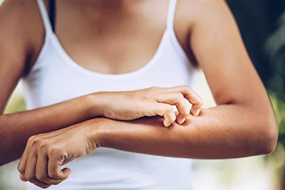 Cahaba Clinical Research - woman itching arm