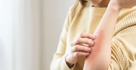 How to Join Dermatology Clinical Trials in Birmingham Without Insurance or Residency Proof