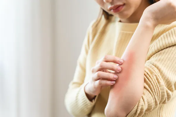 How to Join Dermatology Clinical Trials in Birmingham Without Insurance or Residency Proof