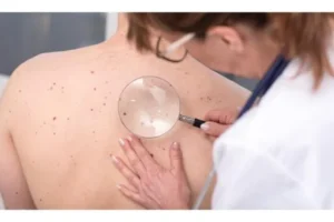 A Quick Skin Check: Clues You Can See and Feel