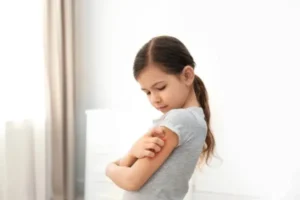 Children’s Atopic Dermatitis Study for Ages 6–11
