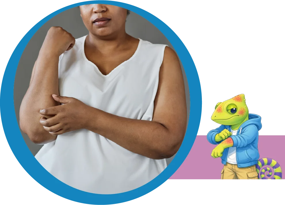 Person flexing their upper arm inside a blue circular frame, with a cartoon lizard mascot on a purple stripe nearby.