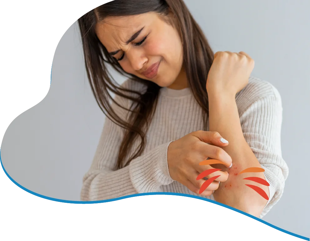 Woman grimacing in discomfort while scratching an itchy forearm with a red rash on the skin.