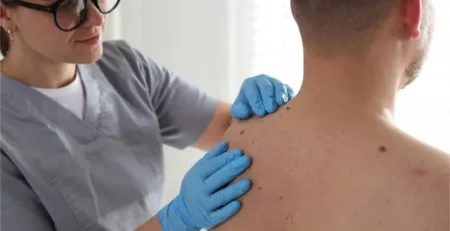No Insurance or Proof of Residency is Required for Dermatology Clinical Trials in Birmingham